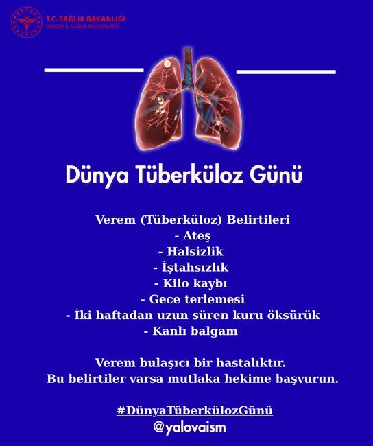 Uzmanlar Verem Belirtilerine Karşı